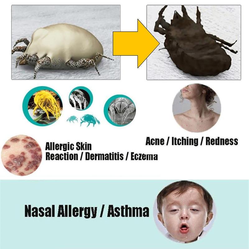 Natural Dust Mites Treatment For Your Bed Sheets, Mattresses & Pillows