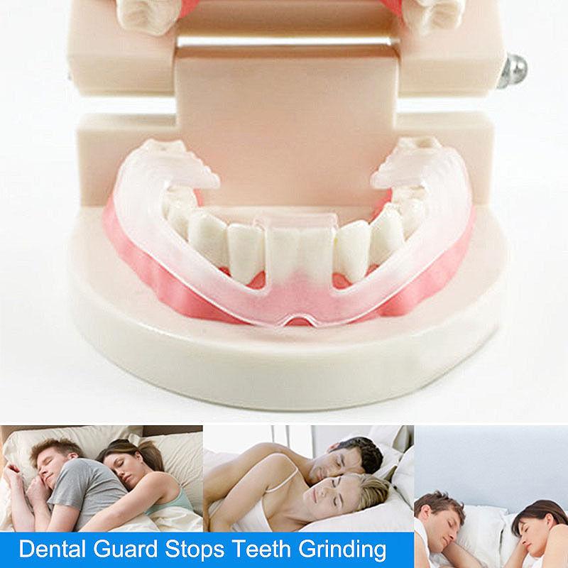 Mouth Guard for Teeth Grinding, Bruxism Treatment