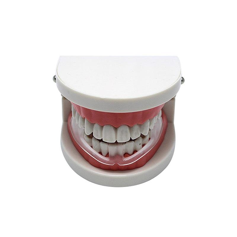 Mouth Guard for Teeth Grinding, Bruxism Treatment