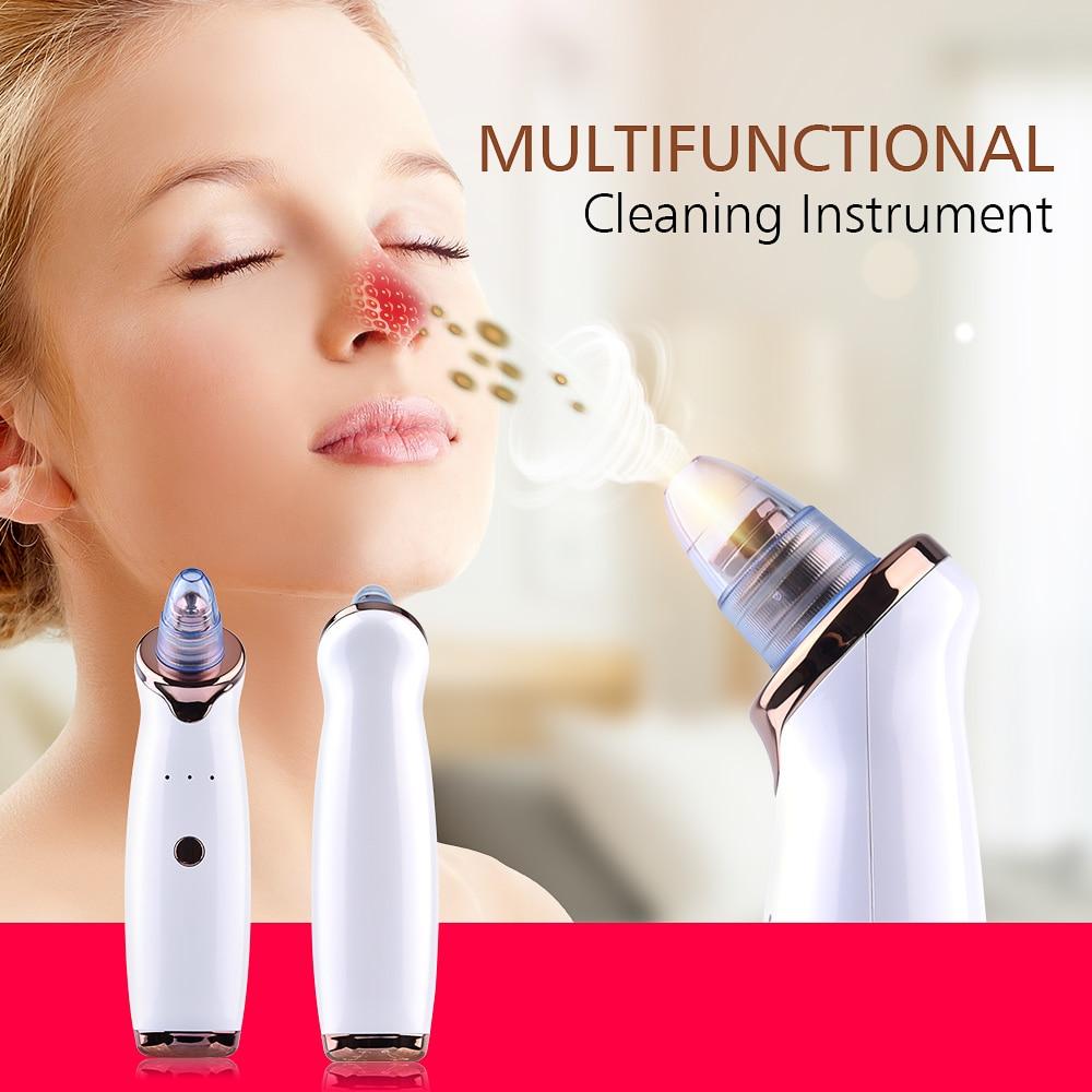 Vacuum Blackhead Removal Tool With Microdermabrasion, Acne Treatment