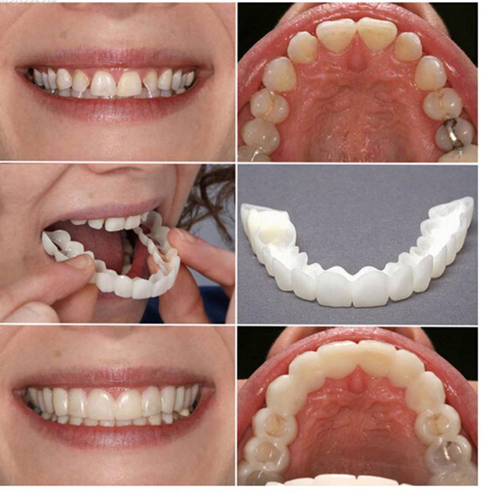Teeth Whitening Dental Cover