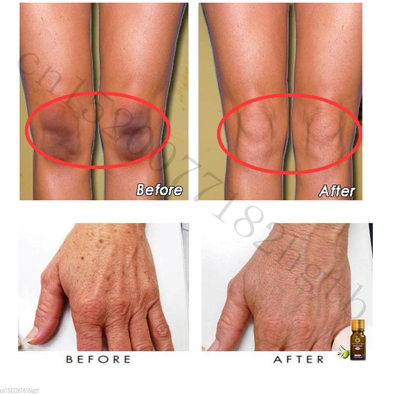 Ultra Brightening Spotless Oil For Skin Spots