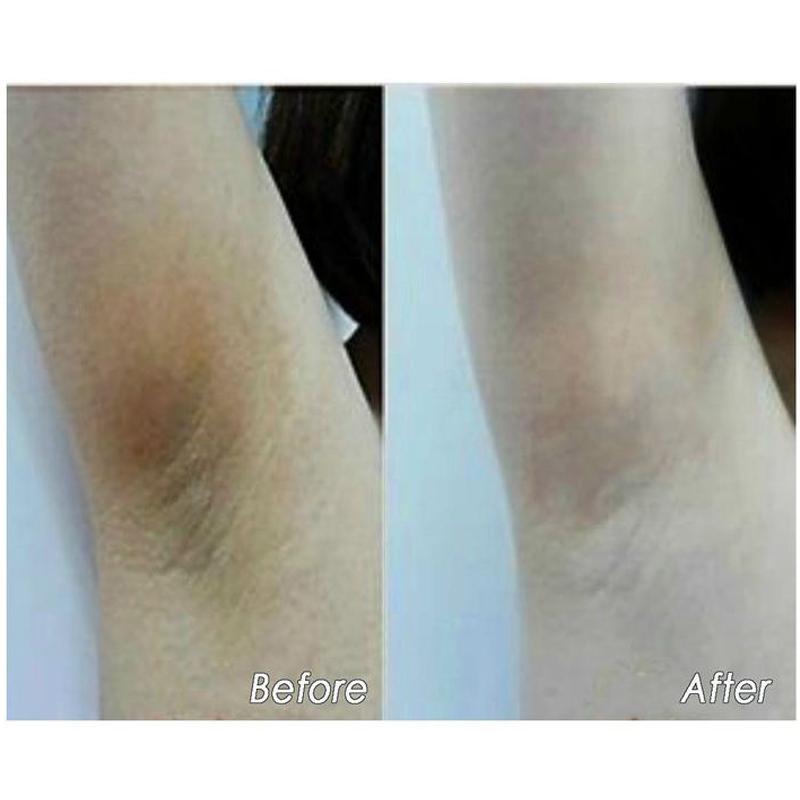 Ultra Brightening Spotless Oil For Skin Spots