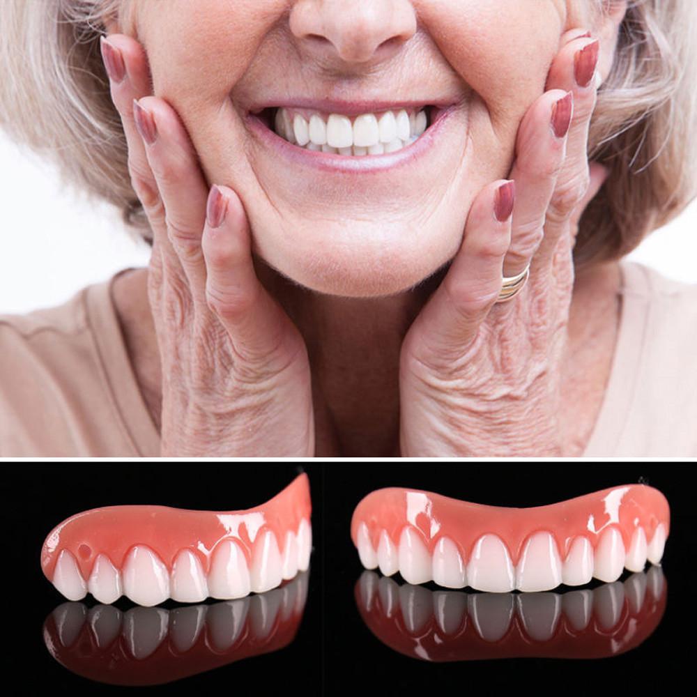 Instant Smile Cosmetic Veneer