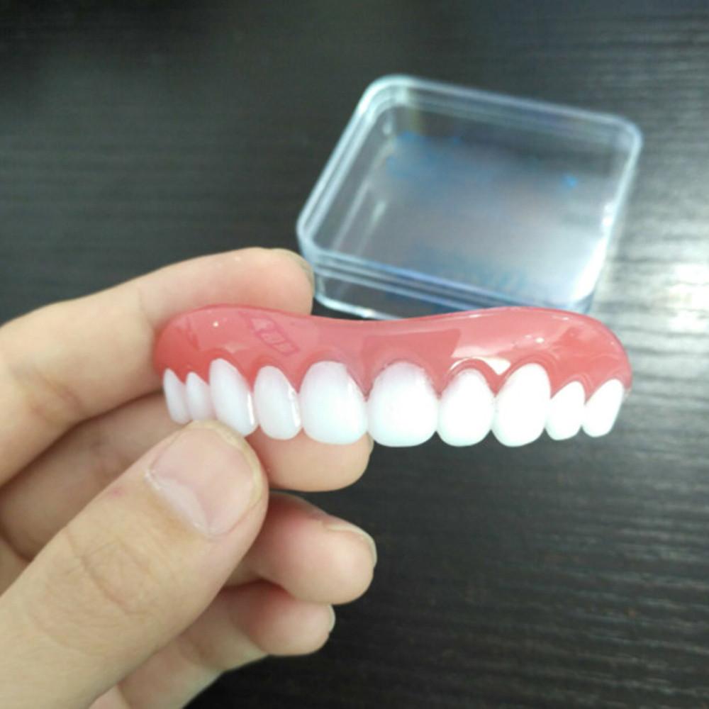 Instant Smile Cosmetic Veneer