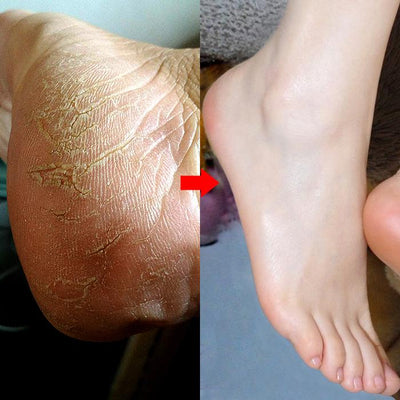 Magic Feet Exfoliating Mask