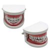 Mouth Guard for Teeth Grinding, Bruxism Treatment